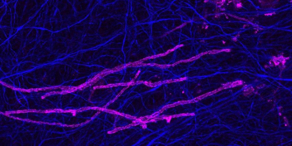 Myelin sheaths (magenta) wrapping axons (blue) in the rodent brain